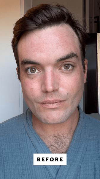Manso before applying the Chanel Les Beiges WaterFresh Tint